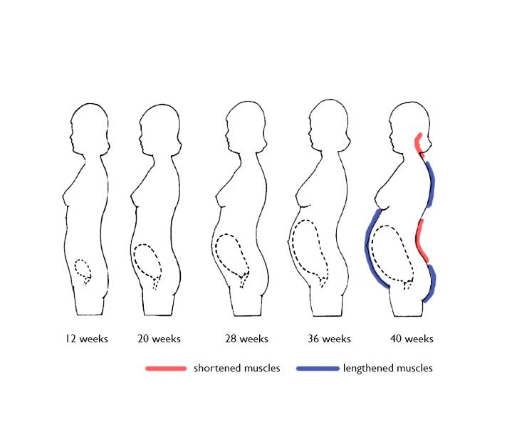 Pregnancy Postural Changes